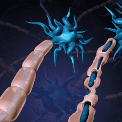 o-que-e-esclereose-multipla